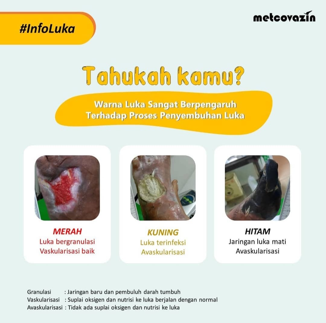 POSTER WARNA LUKA